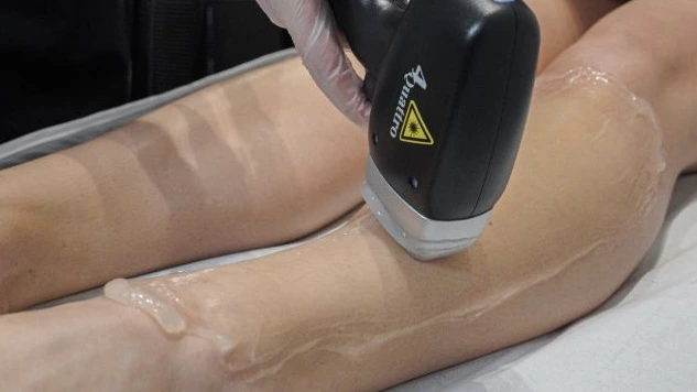 Full body laser hair removal for women | Épilation laser corps complet pour femmes